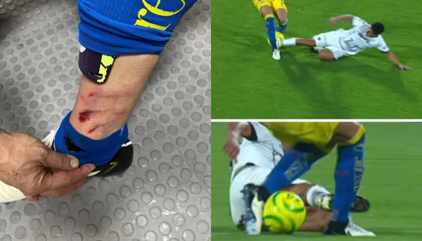 El central del América sufrió una entrada criminal y no marcaron nada.