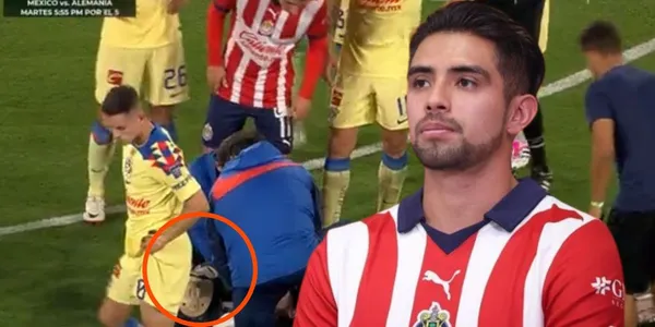 El delantero de Chivas golpeó fuertemente al defensor mexicano de las Águilas.