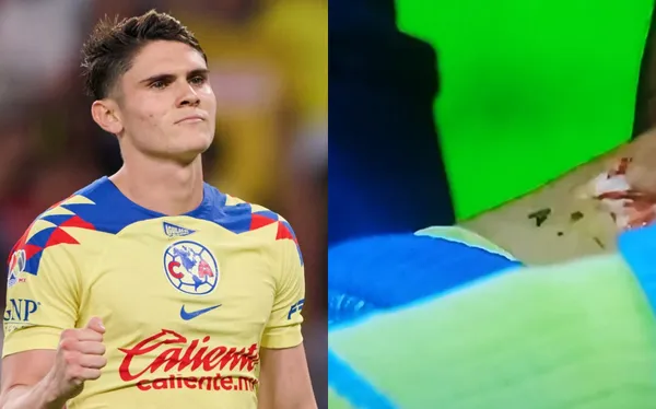 Fue intervenido quirúrgicamente.